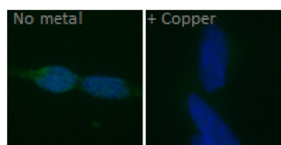 Images of kidney cells that are stained for C-peptide (green) and nuclei (blue). In the absence of metals, C-peptide is taken up by the cells, but with copper present the amount of C-peptide taken up decreases.